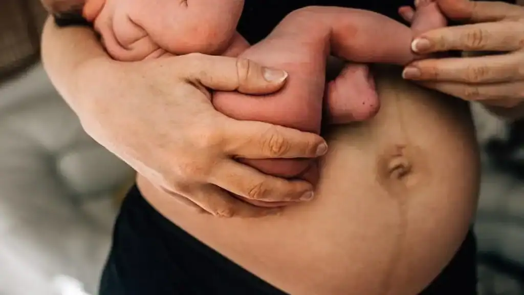 Why Is My Stomach Still Big After Pregnancy Birchfield?